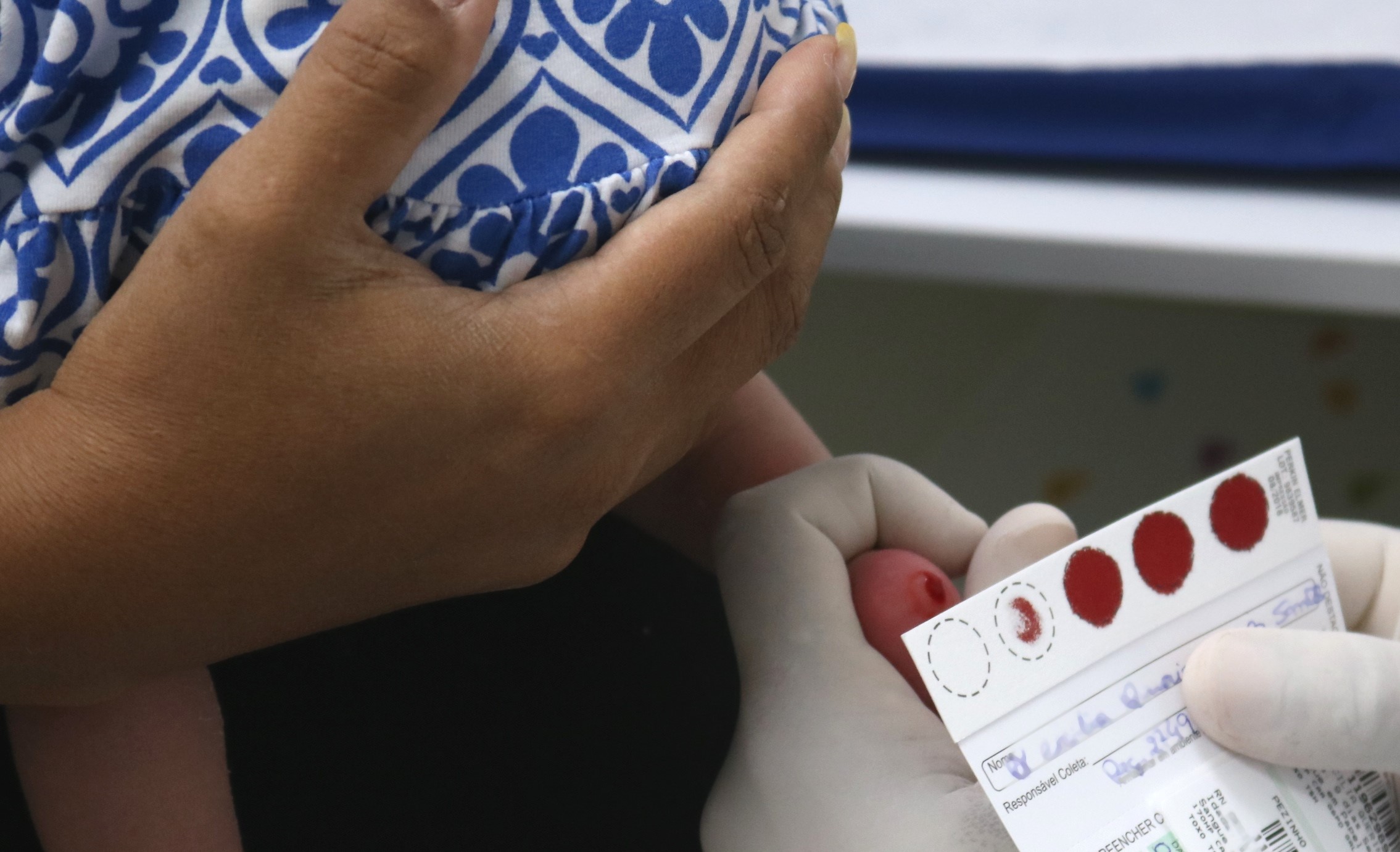 Teste do pezinho permite a detecção de diversas enfermidades e deve ser realizado entre o 3º e 5º dia de vida do bebê