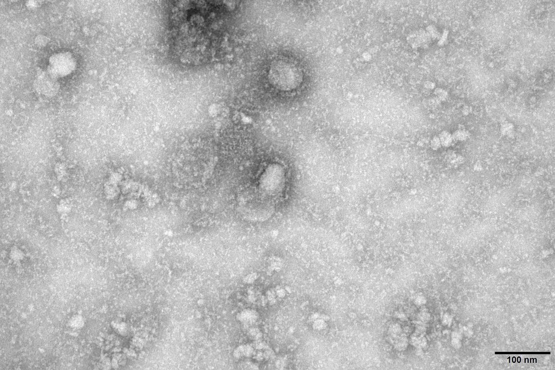 Imagem de Número total de mortes em decorrência do coronavírus ultrapassa 360