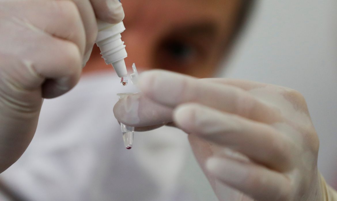 Estado teve quase 10 mil confirmações da doença em 24 horas