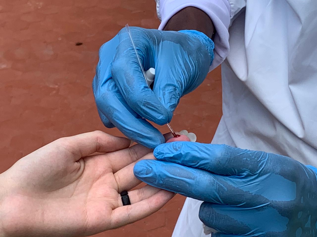 A medida tem o objetivo de estimar melhor a magnitude e evolução da transmissão viral na cidade