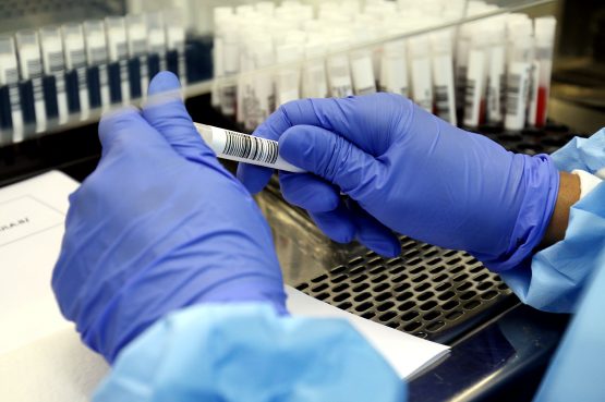 O Laboratório Central de Saúde Pública da Bahia (Lacen-BA) iniciará o sequenciamento de 300 novas amostras dos estados da Bahia, Sergipe, Alagoas, Piauí, Pernambuco e Rio Grande do Norte