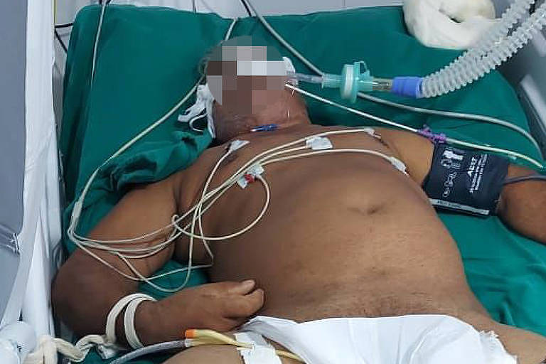 Paciente com Covid-19 intubado e com as mãos atadas às cama em hospital de campanha em Porto Velho, devido à falta de sedativos