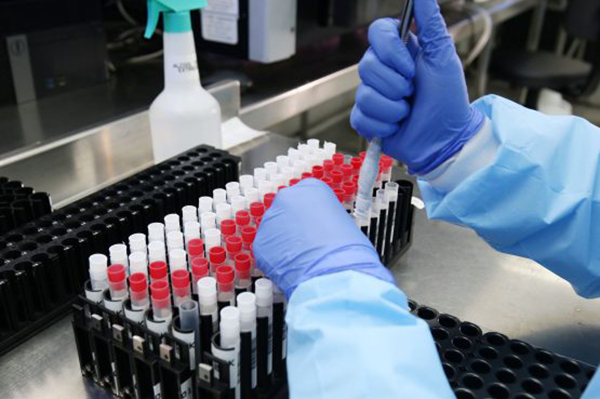 Laboratório Central de Saúde Pública da Bahia (Lacen-BA)