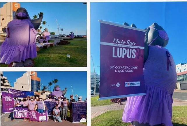 No Maio Roxo, Ireuda Silva defende maior cuidado e qualidade de vida para pessoas com lúpus