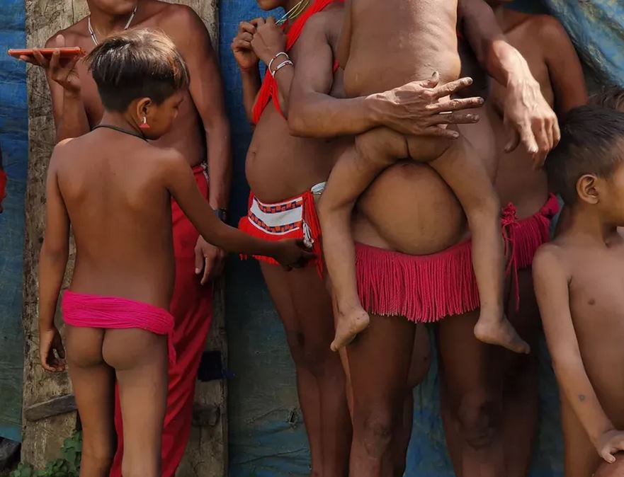 Crianças yanomamis em Roraima enfrentam dificuldade no acesso à saúde Crianças yanomamis em Roraima enfrentam dificuldade no acesso à saúde