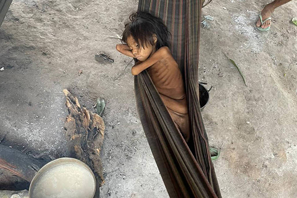 Com quadro de verminose e malária, criança yanomami dorme em rede na aldeia Maimasi, na Terra Indígena Yanomami, em Roraima Com quadro de verminose e malária, criança yanomami dorme em rede na aldeia Maimasi, na Terra Indígena Yanomami, em Roraima