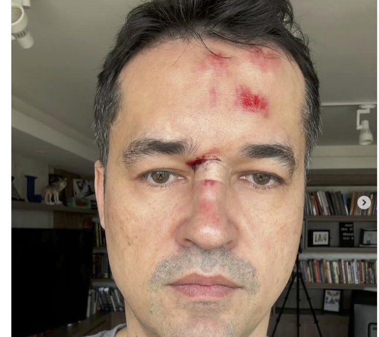 O ex-deputado federal Deltan Dallagnol