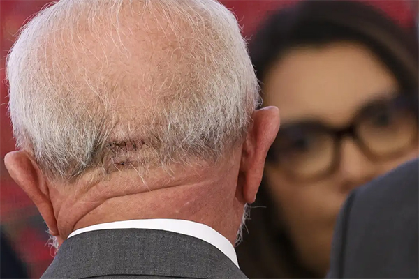 Presidente Lula em sua primeira agenda pública seis dias após ter sofrido um acidente doméstico, no qual caiu no banheiro e bateu a cabeça