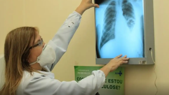  Estudo mostra que tendência do país é ter aumento de casos